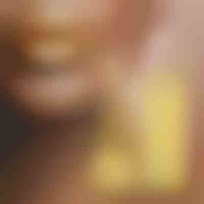 Zlatni ruž | GOLDKISS