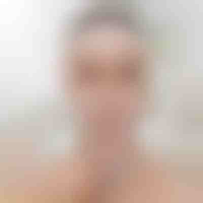 Traka za podizanje i oblikovanje lica | KIMLIFT